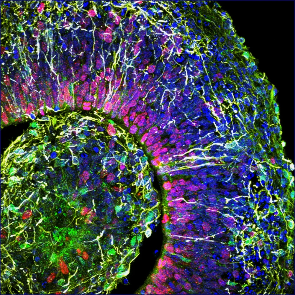 In this image recieved by AFP on Thursday from Muotri Lab at UC San Diego, a cross-section of a brain organoid, showing the initial formation of a cortical plate, with each color marking a different type of brain cell. Scientists have picked up electrical activity in pea-sized lab grown brains for the first time, paving the way to model neurological conditions and answer fundamental questions on how our gray matter develops. It's not clear whether the mini-brains are conscious — the team behind the breakthrough suspect they're not but can't say for sure — opening up a new ethical dimension to the area of research moving forward. — AFP