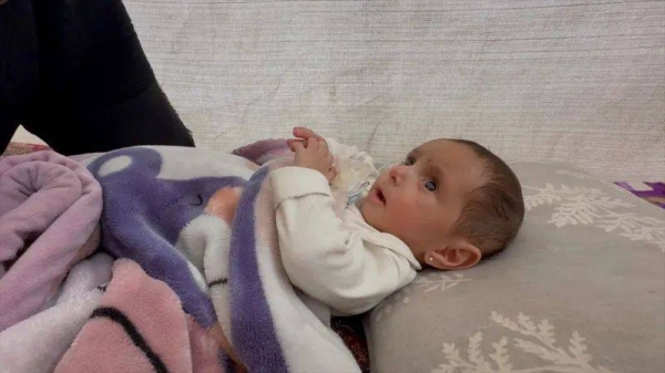 Seven-month-old Niveen needed open-heart surgery outside Gaza