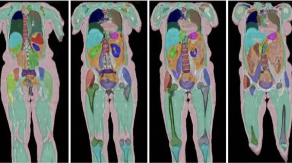 An image from the UK Biobank project. It shows for MRI scans of the body showing the legs and major organs including the heart, spine and stomach in different colors.