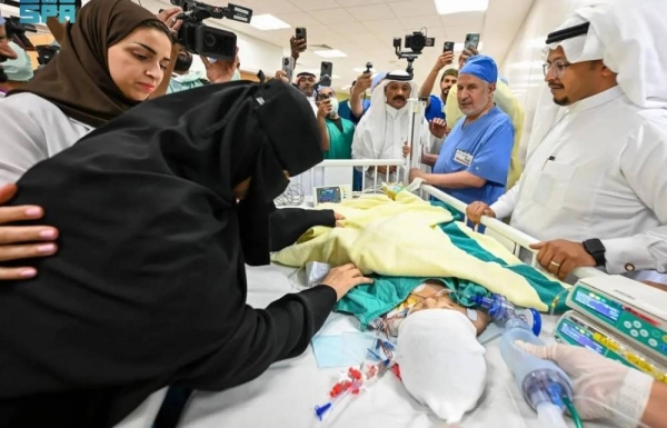 Saudi conjoined twins Yara and Lara successfully separated in 12.5-hour surgery