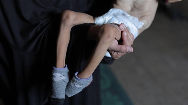 Five more Palestinians, including two children, die of starvation in Gaza